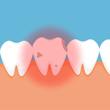 Disease Dental Stock Video 325095