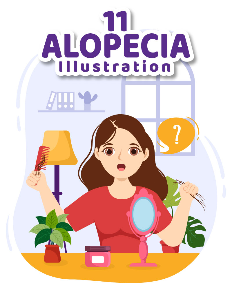 11 Alopecia Hair Loss Illustration