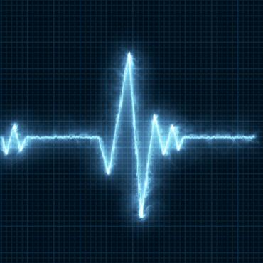 Beat Cardiac  326254