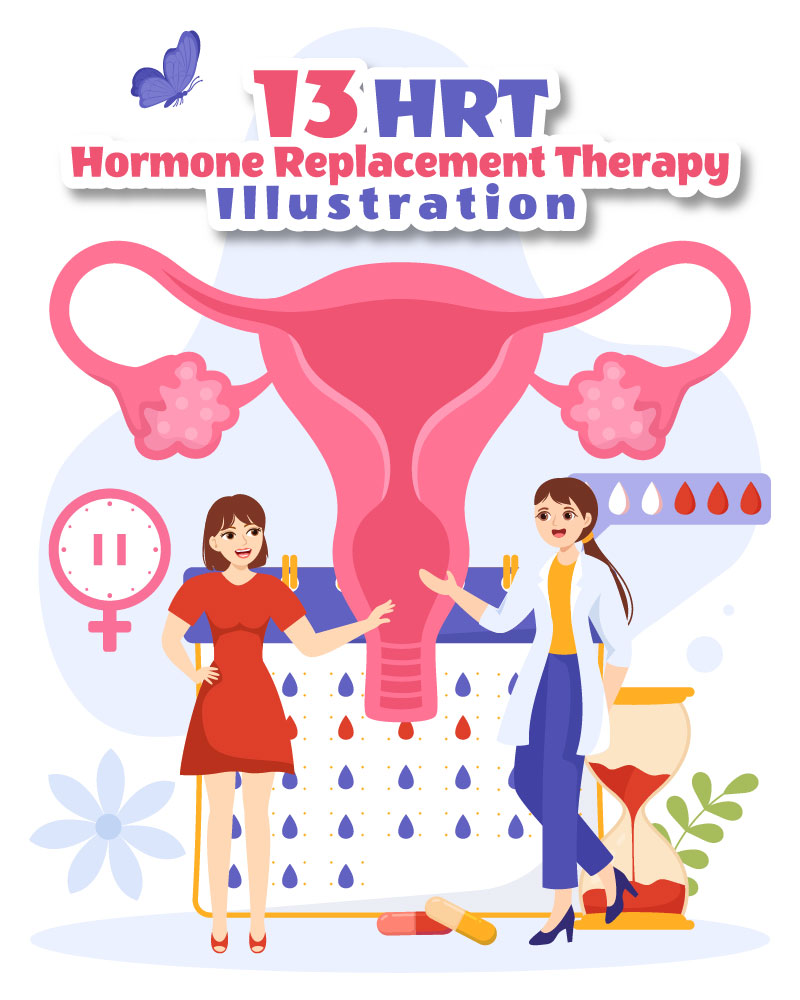 13 Hormone Replacement Therapy Illustration