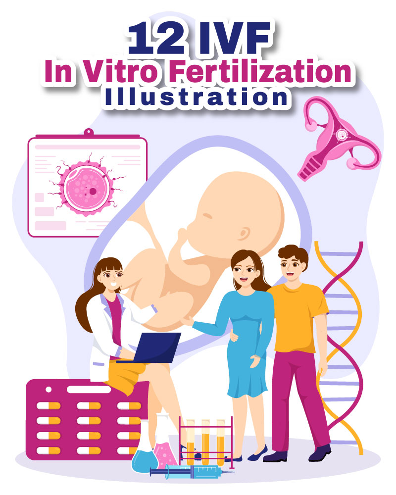 12 IVF or In Vitro Fertilization Illustration