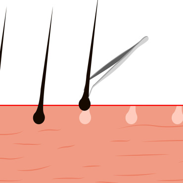 Process Anatomical Stock Video 337179