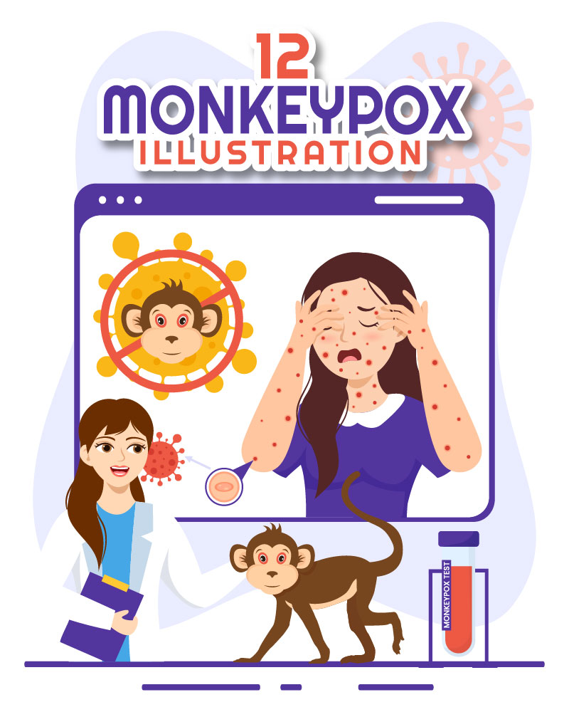 12 Monkeypox Outbreak Illustration