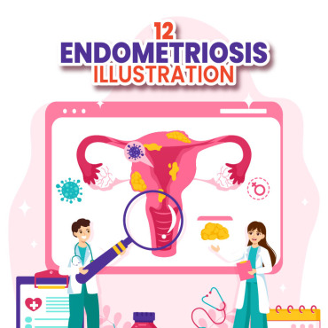 Gynecology Uterus Illustrations Templates 404036